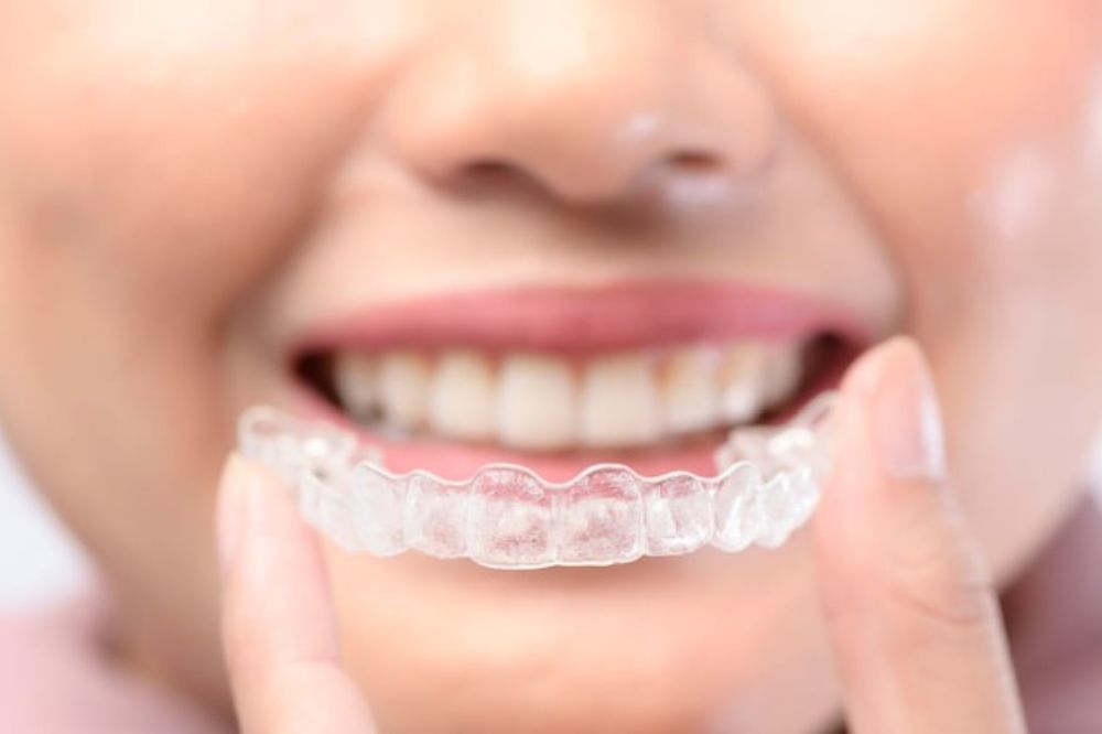 Invisalign Fits a Busy Professional Lifestyle